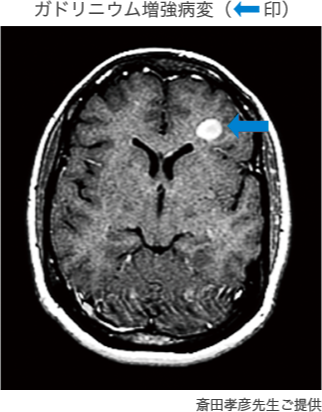 MRI（磁気共鳴画像）検査